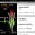 Vibration-Monitoring-for-Android